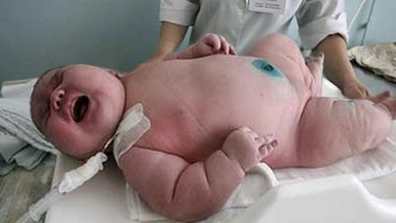 Foto. O femeie de 250 de kilograme a născut un copil gigant! Medicii au rămas fără cuvinte când au văzut bebeluşul