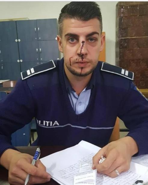 Poliţistul lovit de un şofer beat spune adevărul despre ce s-a &icirc;nt&acirc;mplat. Sorin Cepoi: "Pe stradă, lucrurile nu sunt ca &icirc;n filme"