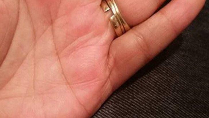 Realitatea din spatele acestei fotografii: emoţionantă! Motivul pentru care femeia aceasta  poartă pe inelar două verighete &icirc;ntregi şi una ruptă!