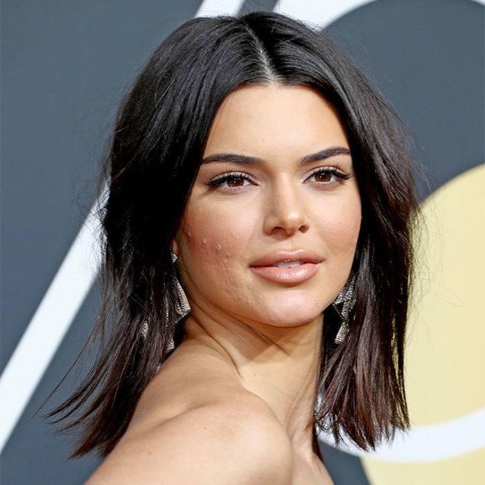 Nu te mai rușina, chiar și cel mai bine plătit model din lume suferă de acnee. Kendal Jenner s-a simțit discriminată
