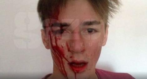 Imagine șocantă a unui tânăr bătut de propriul profesor! „M-a luat la pumni și m-a dat cu capul de o margine”
