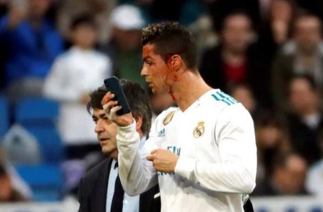 Cristiano Ronaldo, plin de sânge pe teren! A cerut un telefon mobil pentru a-și vedea rana la cap