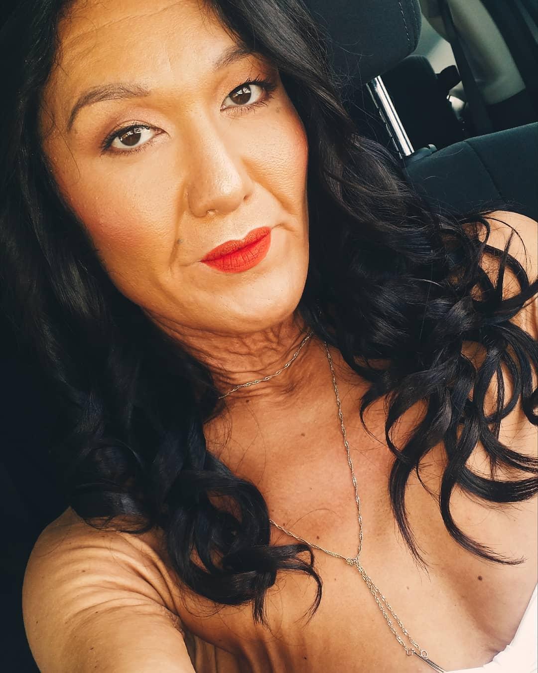 Tu ce v&acirc;rstă &icirc;i dai? Modelul care suferă de o boală rară este o inspirație pentru noi toți