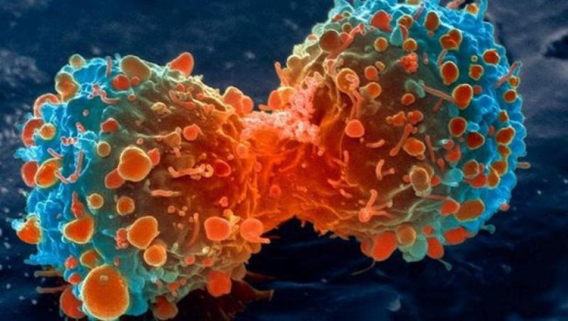 S-a descoperit leacul pentru CANCER! Doi cercetători au primit PREMIUL NOBEL pentru descoperirea unei TERAPII anti-cancer