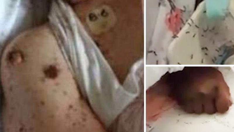 O femeie în stare gravă, găsită acoperită de furnici, în spital! Autoritățile au demarat o anchetă
