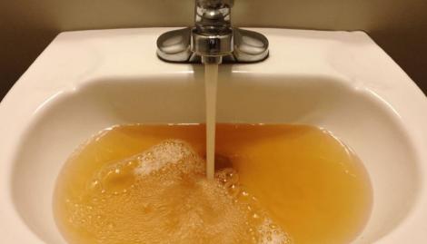 Sănătatea noastră este în pericol! ,,La robinet curg bacterii, apa nu este potabilă. Ministerul Sănătății recunoaște" Un deputat spune tot