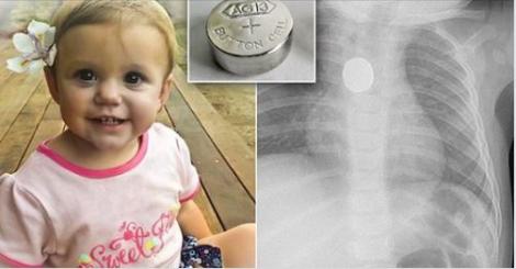 A murit din cauza incompetenței medicilor! După ce a înghițit o baterie de ceas, o fetiță de 1 an a fost trimisă de doctori acasă, în repetate rânduri