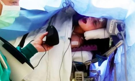 O tânără a cântat în timpul unei operații pe creier. Medicii au ținut ritmul și au fredonat alături de ea – VIDEO