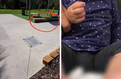 Pericol în parcuri! O fetiță de 2 ani se afla la locul de joacă, când deodată se aud niște urlete de durere. Mama a întors capul spre ea și a ,,paralizat" când a văzut ce pățise fetița