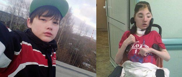 A murit băiețelul erou! T&acirc;nărul de 16 ani s-a stins pe patul de spital din cauza rănilor!