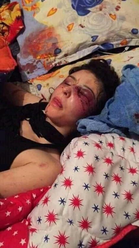 Petiție online. 20.000 de semnături pentru tânara bătută din Ploiești! Imaginile cu ea ghemuită pe un pat, plină de sânge, fac înconjurul internetului