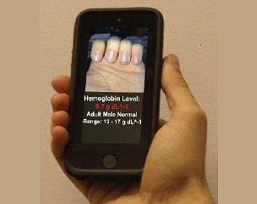 A fost inventată aplicația mobilă ce poate detecta anemia! Nu mai este necesară recoltarea s&acirc;ngelui