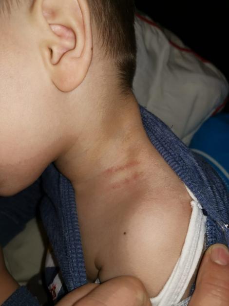 Părinții unui băiețel de trei ani acuză o educatoare că le-ar fi strâns de gât fiul și l-ar fi tras de zona intimă