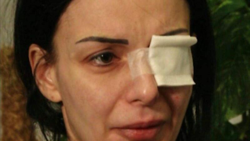 Mărturiile cutremurătoare ale Alinei, românca atacată cu acid: „Am crezut că o să mor, mă gândeam doar la fiul meu”