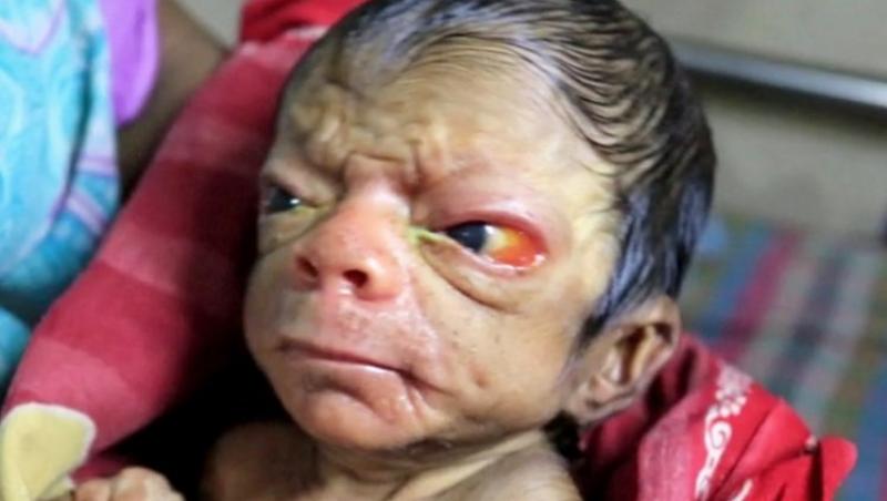 O femeie a născut un bebeluș  care arată precum un bătrân de 80 de ani! Medicii au fost uimiți când l-au văzut pe micuț. GALERIE FOTO