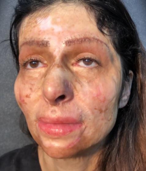 Reacția unei femei desfigurate, machiată pentru prima dată! VIRALUL la care toți au pl&acirc;ns