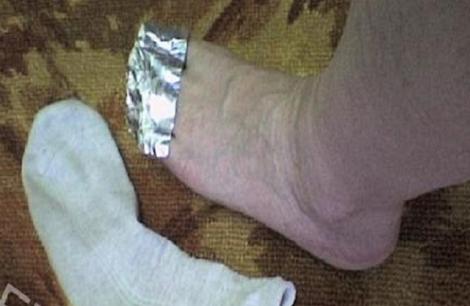 Ce se întâmplă dacă pui o bucată de aluminiu pe degetele de la picioare! Rezultatul e incredibil