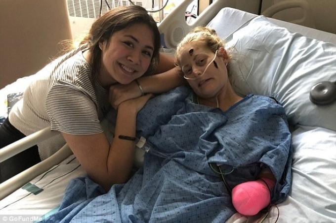 Dramatic! Viața unei femei a fost distrusă &icirc;n urma unei răceli! Motivul pentru care medicii au decis să-i amputeze m&acirc;inile și picioarele!&nbsp;