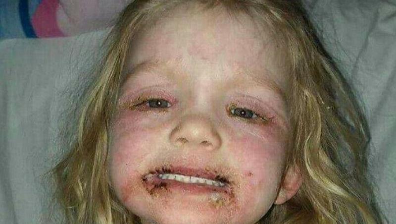 O fetiță de trei ani, desfigurată de machiajul ieftin! Prin ce chin a trecut după ce a folosit un ruj și un fard de obraz cumpărate de la un magazin local