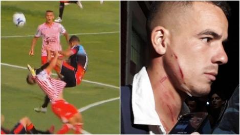 VIDEO: Accidentare groaznică în Argentina. Un fotbalist a fost la un pas de tragedie după o intrare criminală a unui adversar