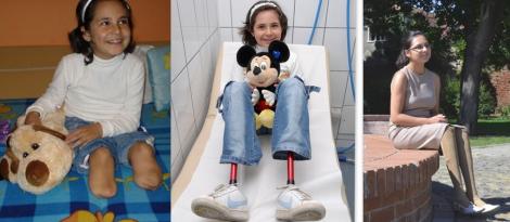 La șase ani, medicii îi amputau membrele: "Mami, fii puternică! Eu sunt!" “Manu, păpușa fără picioare” a devenit o domnișoară care merge pe tocuri