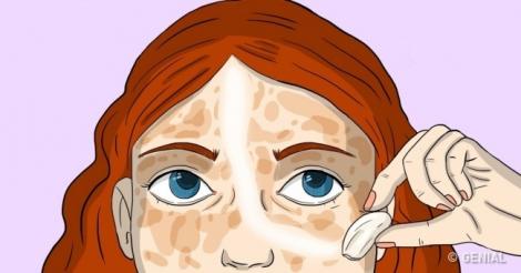 3 remedii naturale care-ți iau petele de pe față precum guma de șters