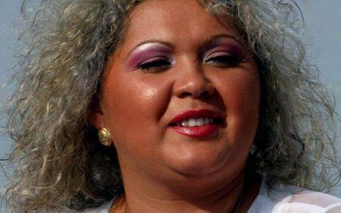 Cum a reușit Minodora să scape de o afecțiune groaznică!  "La noi &icirc;n familie toată lumea are această boală"