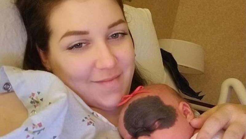 Un bebeluș i-a uimit pe doctori! A venit pe lume cu o pată neagră, care îi acoperă aproape jumătate de față. Părinții: 