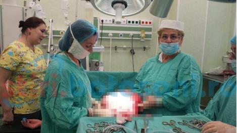 Caz uimitor în România! Un bebeluș s-a născut cu o turmoră gigant, iar medicii fac tot posibilul să-i salveze viața