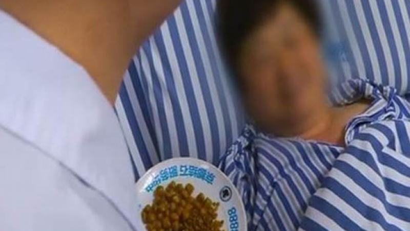 Caz medical șocant! Ce a pățit o femeie după ce a mâncat prea mulți cartofi prăjiți