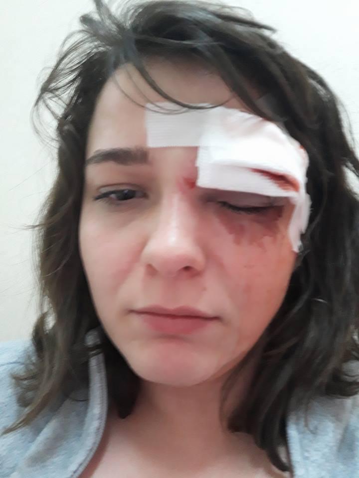 T&acirc;nără, bătută și jefuită, &icirc;n inima Bucureștiului. Mai avea puțin și ajungea acasă: "Mi-am dat seama că ceva se va &icirc;nt&acirc;mpla. Nu am putut dec&acirc;t să țip după ajutor și să-l mușc"