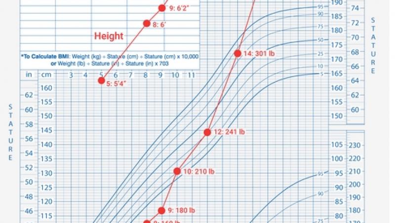 Drama URIAŞULUI BLÂND, cel mai înalt om care a trăit vreodată. La 5 ani purta haine de 17, la 9 îşi depăşea tatăl, la 22 avea deja 2,72 metri