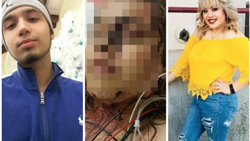 Atenție, imagini socante! Un bărbat și-a rupt iubita în bătaie, după ce a prins-o că şi-a descărcat Snapchat-ul. I-au rămas urmele tălplor lui pe scalp