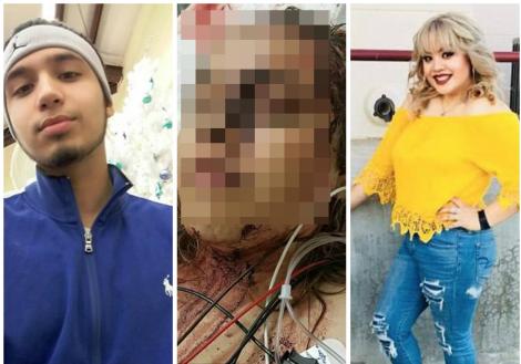 Atenție, imagini socante! Un bărbat și-a rupt iubita în bătaie, după ce a prins-o că şi-a descărcat Snapchat-ul. I-au rămas urmele tălplor lui pe scalp