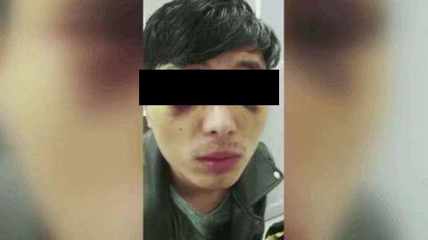 Caz șocant &icirc;ntr-un spital din Rom&acirc;nia! Unui pacient i s-au smuls ochii