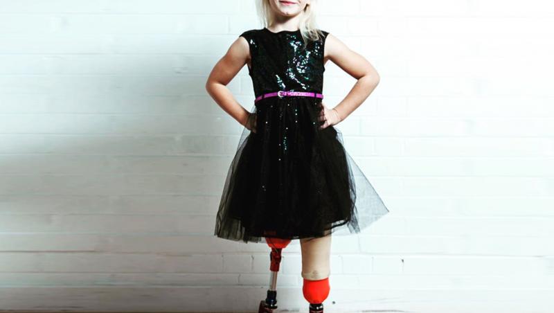 Are doar șapte ani, dar e un munte de voință! Povestea unei fetițe căreia i-au fost amputate picioarele, dar și-a construit o carieră ca model: ”Este OK să fii diferit și să nu te afecteze acest lucru!” 
