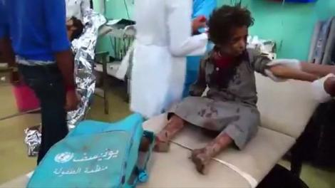 Ororile războiului... Zeci de copii au fost ucişi în Yemen, într-un atac aerian. Atenţie, imagini CUTREMURĂTOARE!
