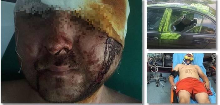 Imagini șocante! Un bărbat de 34 de ani, bătut cu bestialitate, &icirc;n mijlocul zilei! Atacatorul se temea că vrea să-i &rdquo;fure&rdquo; nevasta, așa că i-a aplicat o lecție