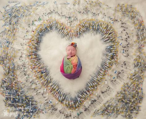 Îți sfâșie inima instant! Motivul pentru care un bebeluș e înconjurat de peste 1.000 de seringi! Fotografia bizară a făcut înconjurul lumii 