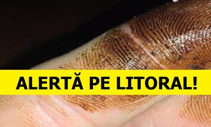 Pericol de MOARTE pe litoralul rom&acirc;nesc! Turiștii care nu se feresc riscă să intre &icirc;n COMĂ!