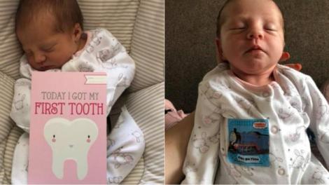 Cazul care i-a uimit pe medici! O fetiță s-a născut cu un dinte, iar la 12 zile a ajuns la dentist! Mărturisirile mamei: ”N-am putut să-mi văd prințesa suferind!”
