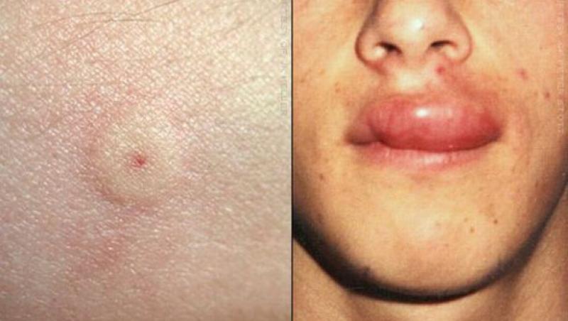 Medicii atrag atenția asupra pericolului din România: ”Trebuie să aveți grijă. Aceste medicamente sunt necesare în permanență!”