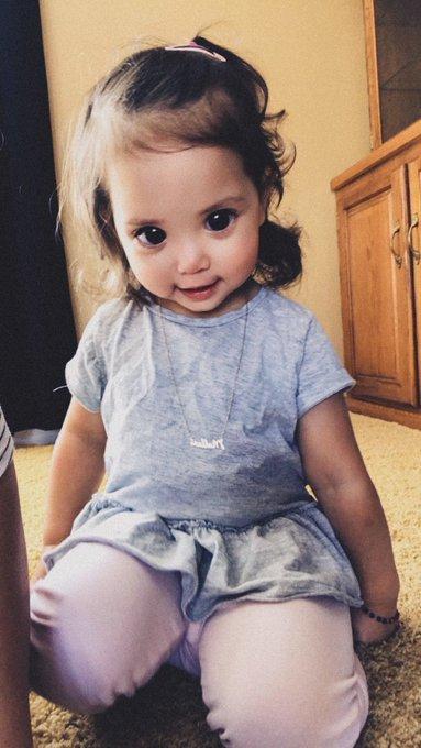 Fetiţa cu cei mai mari ochi din lume. Oamenii o admiră fără să ştie că suferă de o boală genetică rară