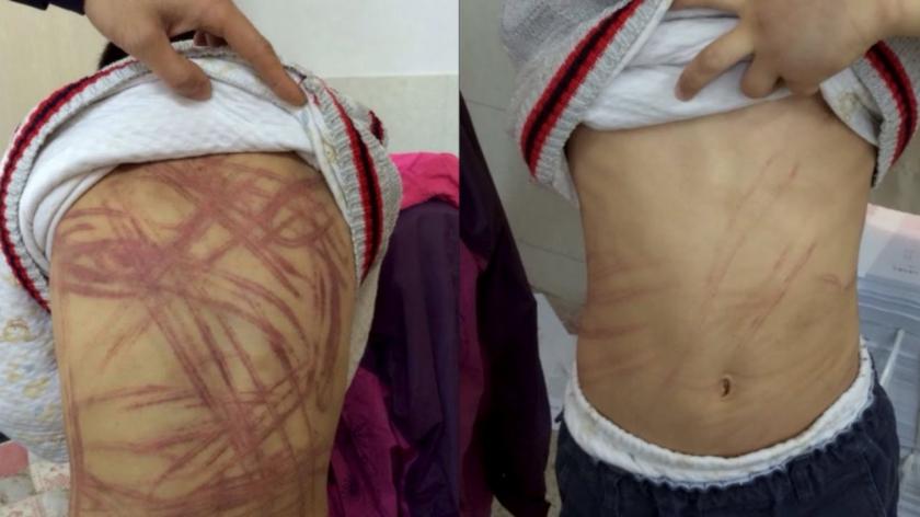 Caz șocant &icirc;n Brașov! Copil din centrul de plasament, bătut cu biciul sub ochii polițiștilor