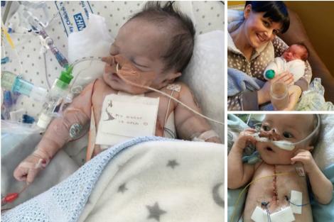 El e Theo, micuțul cu 25 de infarcte într-o singură zi! A trecut prin 17 operații, toate înainte de a împlini un an!