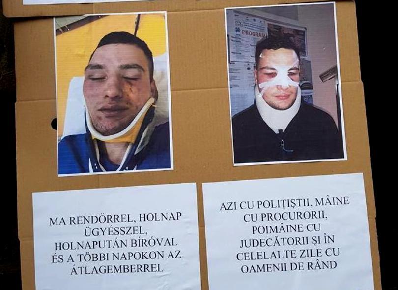 Polițist bătut crunt &icirc;n fața unei pensiuni! A fost urmărit de agresor și după ce a primit primele lovituri