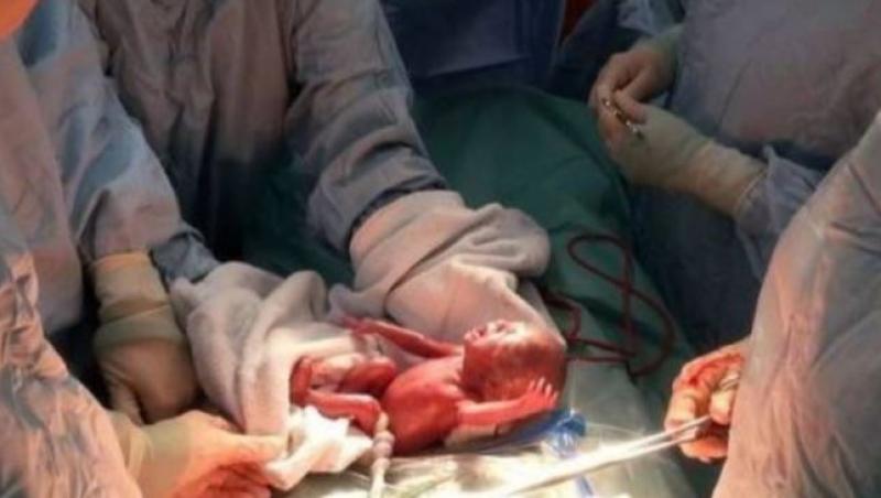 Caz cutremurător la o maternitate din Botoșani! Un bebeluș avortat a refuzat să moară pentru încă 10 ore. Mama copilului nu a dorit să îi salveze viața