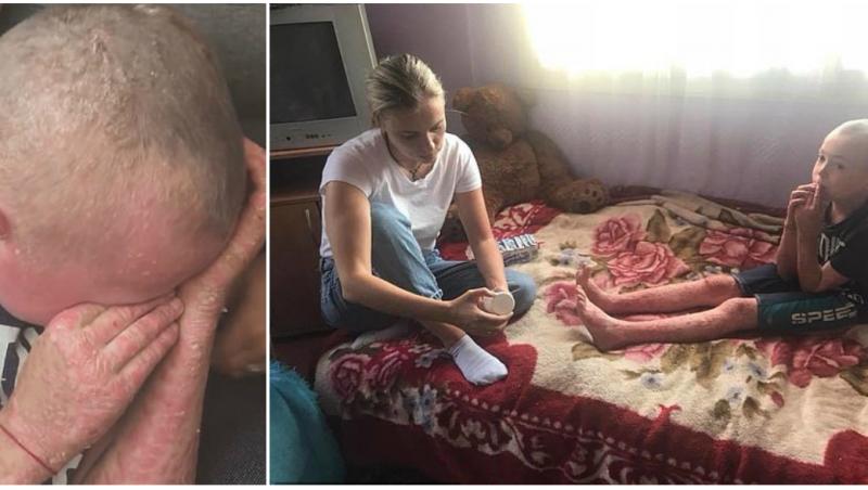 După șase ani de luptă cu boala, Vadim nu mai vrea să îndure durerea: „Mami, nu mai pot să trăiesc așa, prefer să mor”