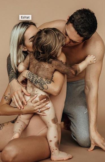 Șocant! O cunocută influenceriță dezvăluie boala ciudată cu care s-a născut copilul său - FOTO