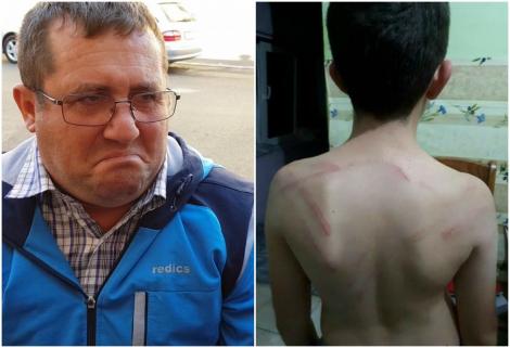 Un copil de 11 ani a fost pedepsit în cel mai crunt mod! Unchiul lui l-a agresat cu un cablu metalic pentru 200 de lei